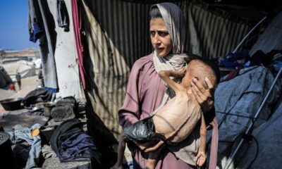 مقتل 21 في غزة وتفاقم المجاعة وإصابة 7 إسرائيليين بدهس