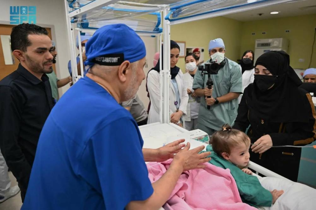 فصل التوأم السوري سيلين وإيلين في مستشفى بالرياض