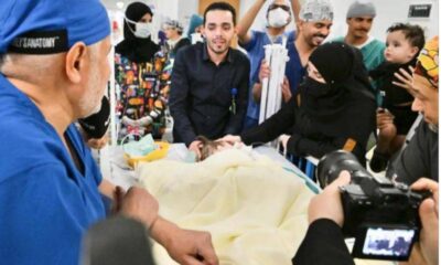 نجاح جراحة فصل التوأم السوري سيلين وإيلين