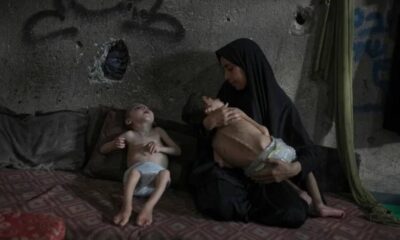 مأساة غزة: 180 ضحية بسبب التجويع والأزمة الإنسانية