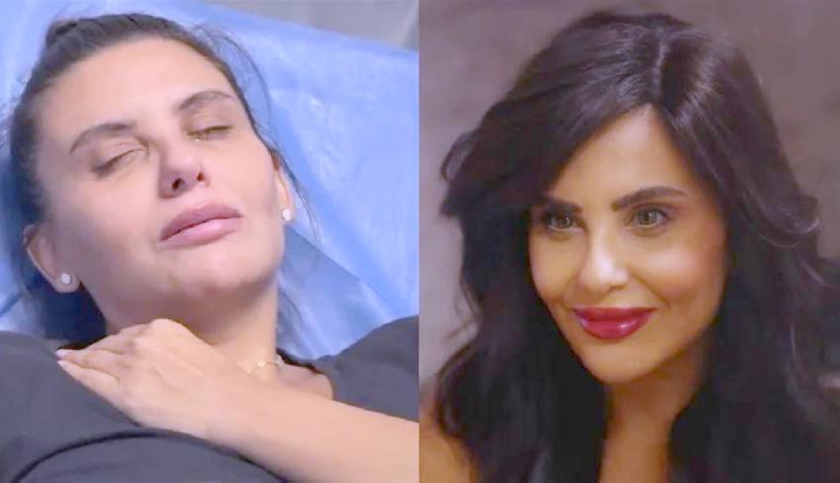 تأثير حقن التجميل على صحة دانا حمدان: تفاصيل مهمة