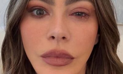 صوفيا فيرغارا تغيب عن حفل الإيمي بسبب الحساسية