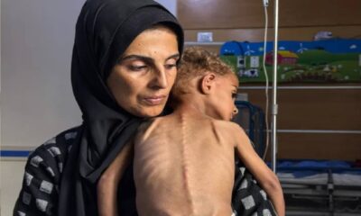 تصعيد إسرائيلي بالضفة والقدس وتجويع أطفال غزة