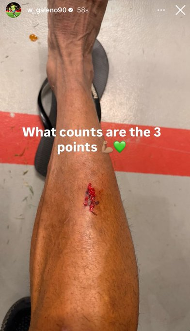 جالينو يوجه رسالة لجماهير الأهلي بعد إصابته أمام ضمك